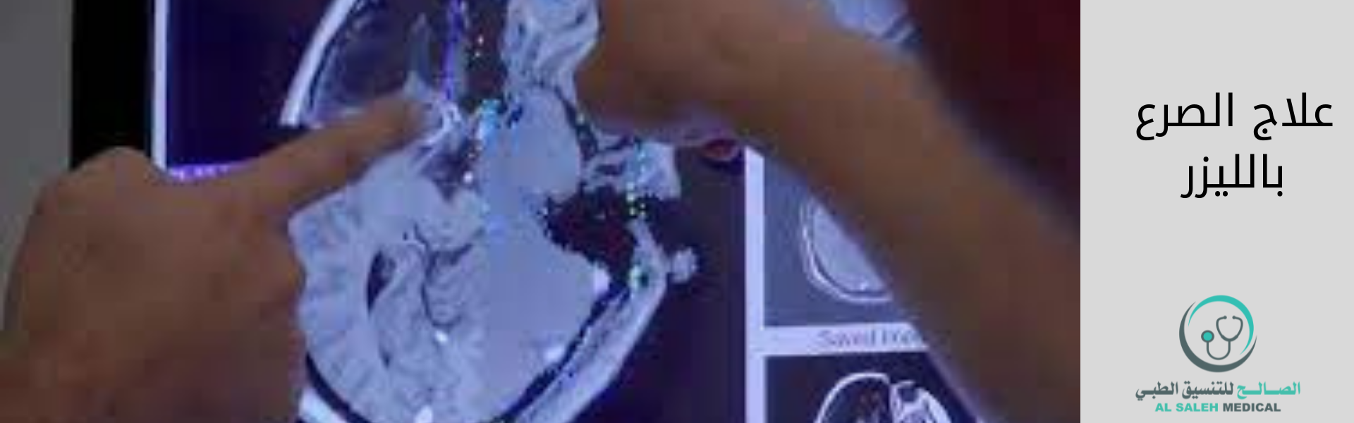 إجراء عملية الاستئصال بالليزر لعلاج الصرع في الهند